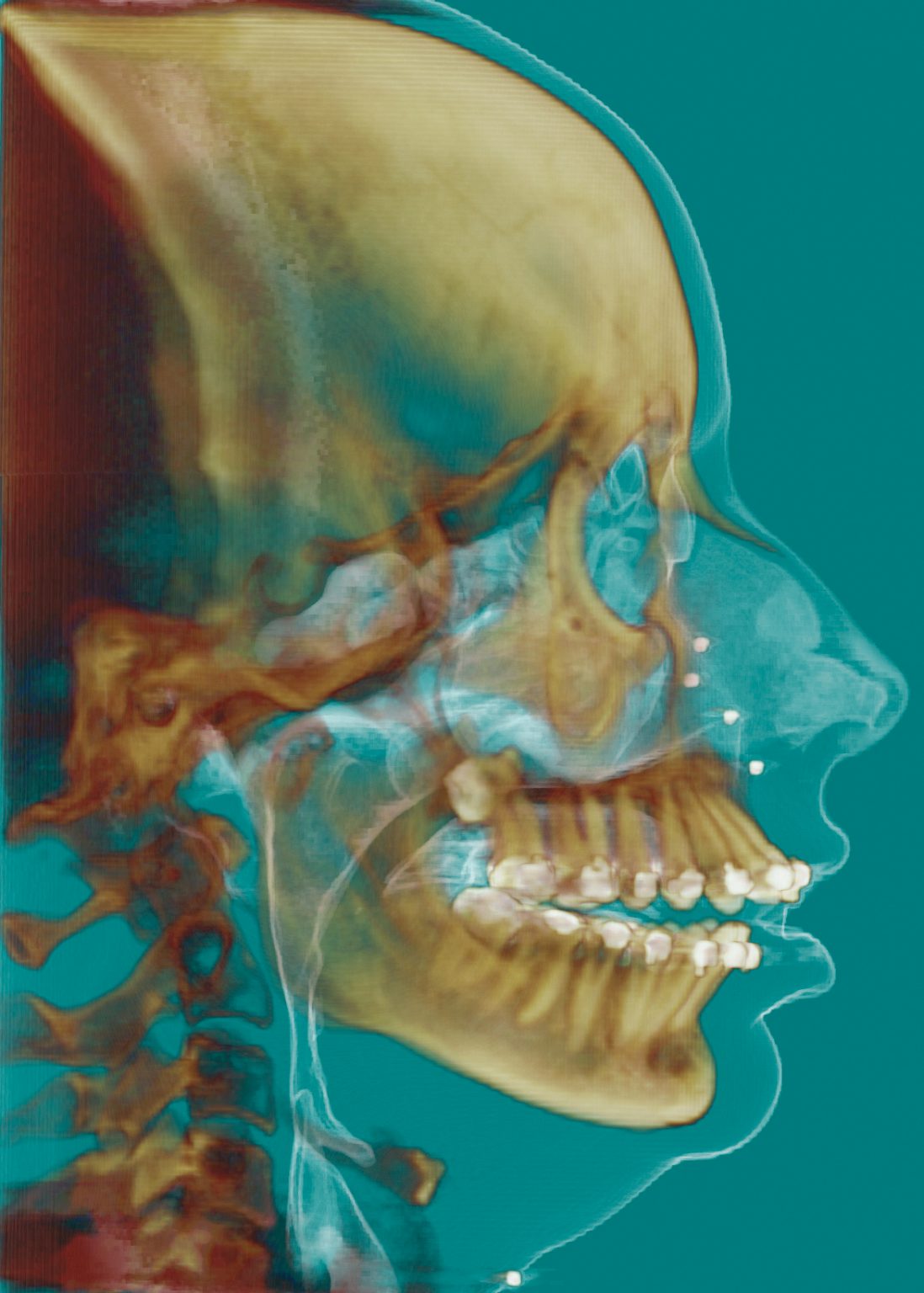 Как загрузить dicom файлы в dolphin imaging